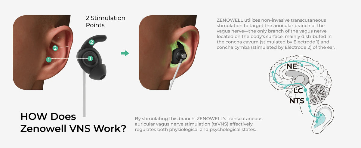 Vagus Nerve Stimulator For Sleep